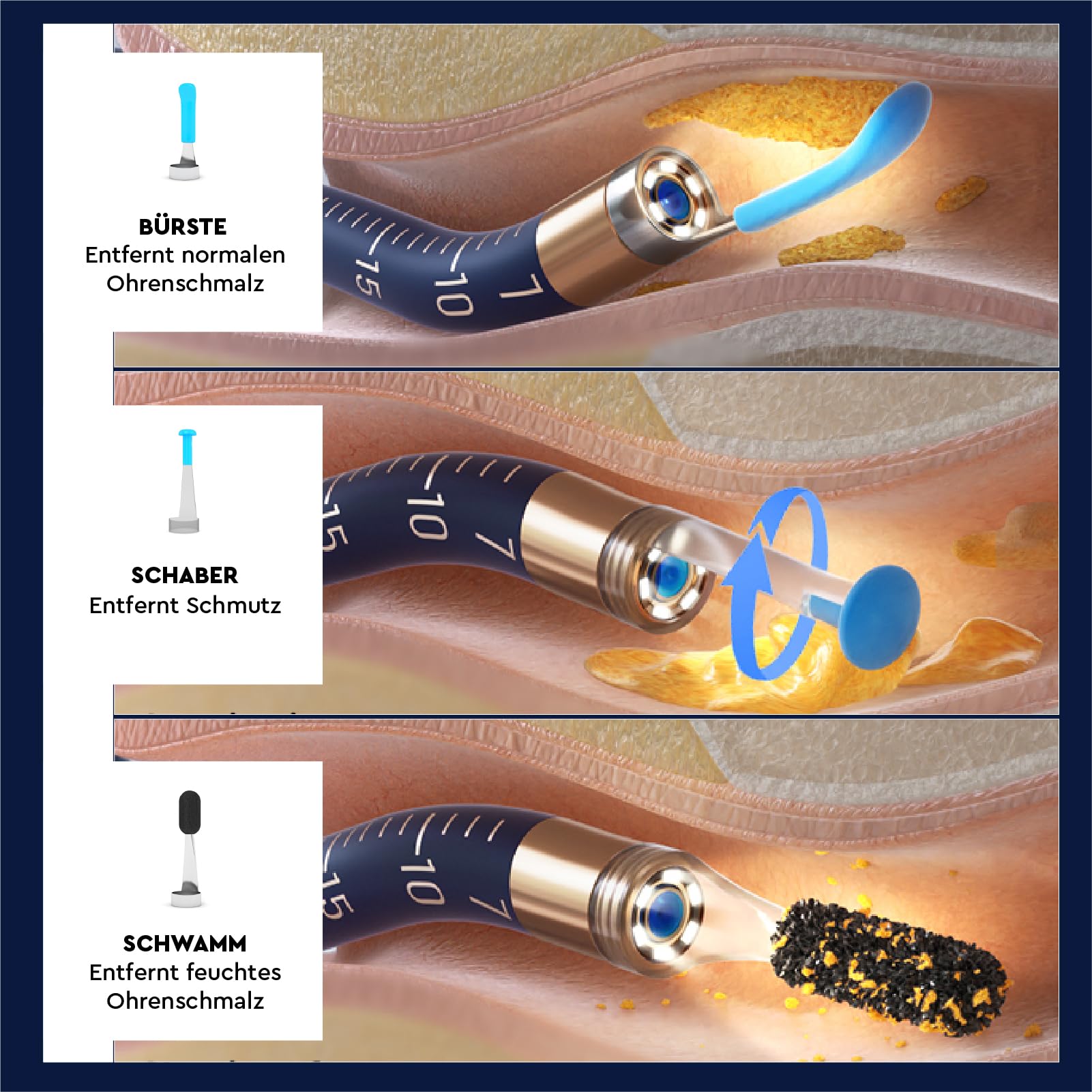 Ohrenschmalz Entferner Otoskop 10MP-HD-Kamera WiFi Flexibler Digitaler Ohrreiniger UdiGuard Pro-Clean Ohrenspiegel mit Pinzette und Austauschbaren Spitzen - Erwachsene und Kinder Hals-Nasen-Ohren-Set