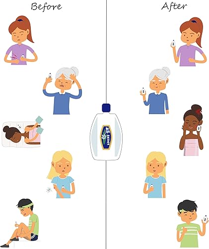 Miniatura 7 de White Flower Aceite de bálsamo analgésico externo de 0.3 fl oz0.338 fl oz, auténtico importación estadounidense (6 paquetes)