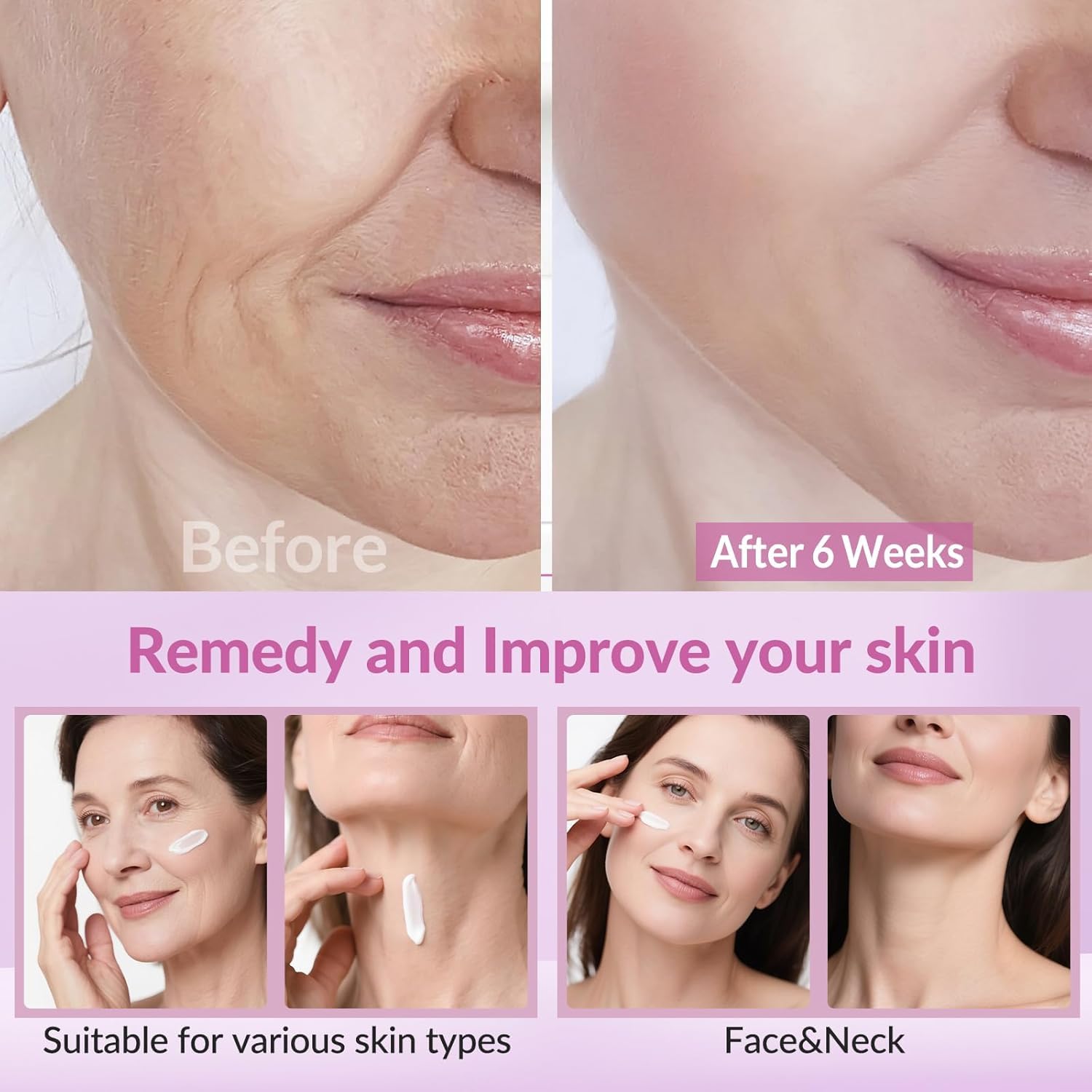 Condition photo showing New/Like New for Neck Firming Creams for Tightening and Firming, Moisturizer Face Cream with Collagen, Hyaluronic Acid, Day & Night Anti-Aging Skin Tightening Cream for Neck, Décolleté & Face – 1.7Fl Oz