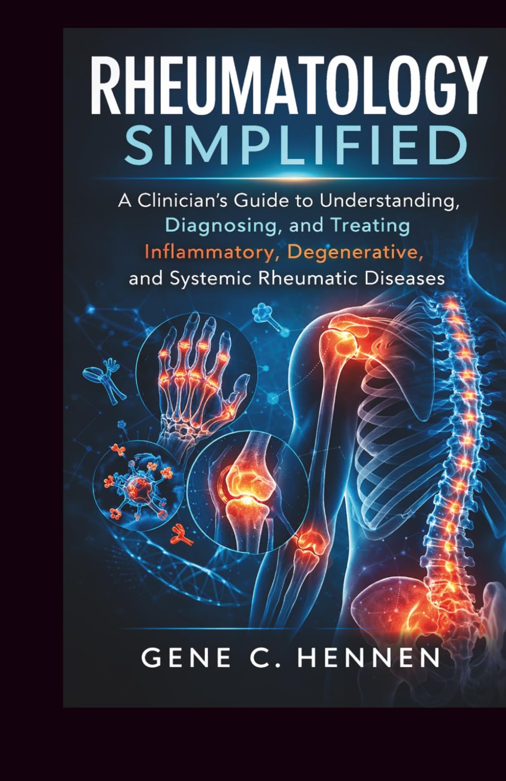 RHEUMATOLOGY SIMPLIFIED: A Clinician's Guide to Understanding, Diagnosing, and Treating Inflammatory, Degenerative, and Systemic Rheumatic Diseases