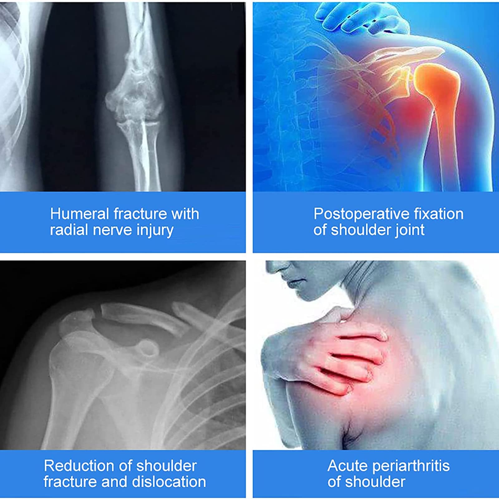 Órtesis de abducción de Hombro para Adultos, Soporte de fijación de Fractura humeral Ajustable, Soporte Fijo de abducción de Hombro, para Fractura de Brazo Roto, dislocación humeral de Hombro