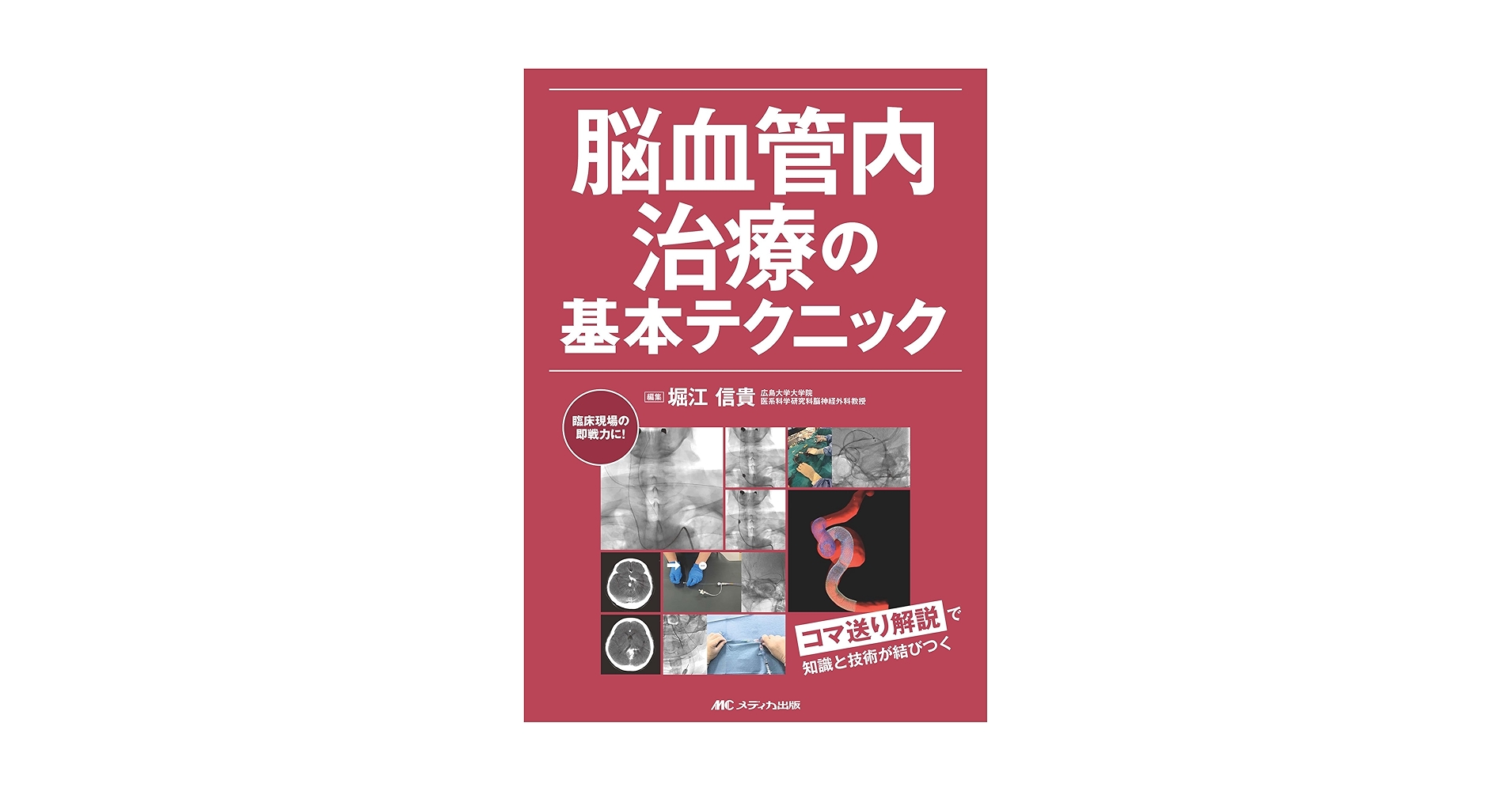 脳血管内治療の基本テクニック : コマ送り解説で知識と技術が結びつく 脳血管内治療の基本テクニック：コマ送り解説で知識と技術が