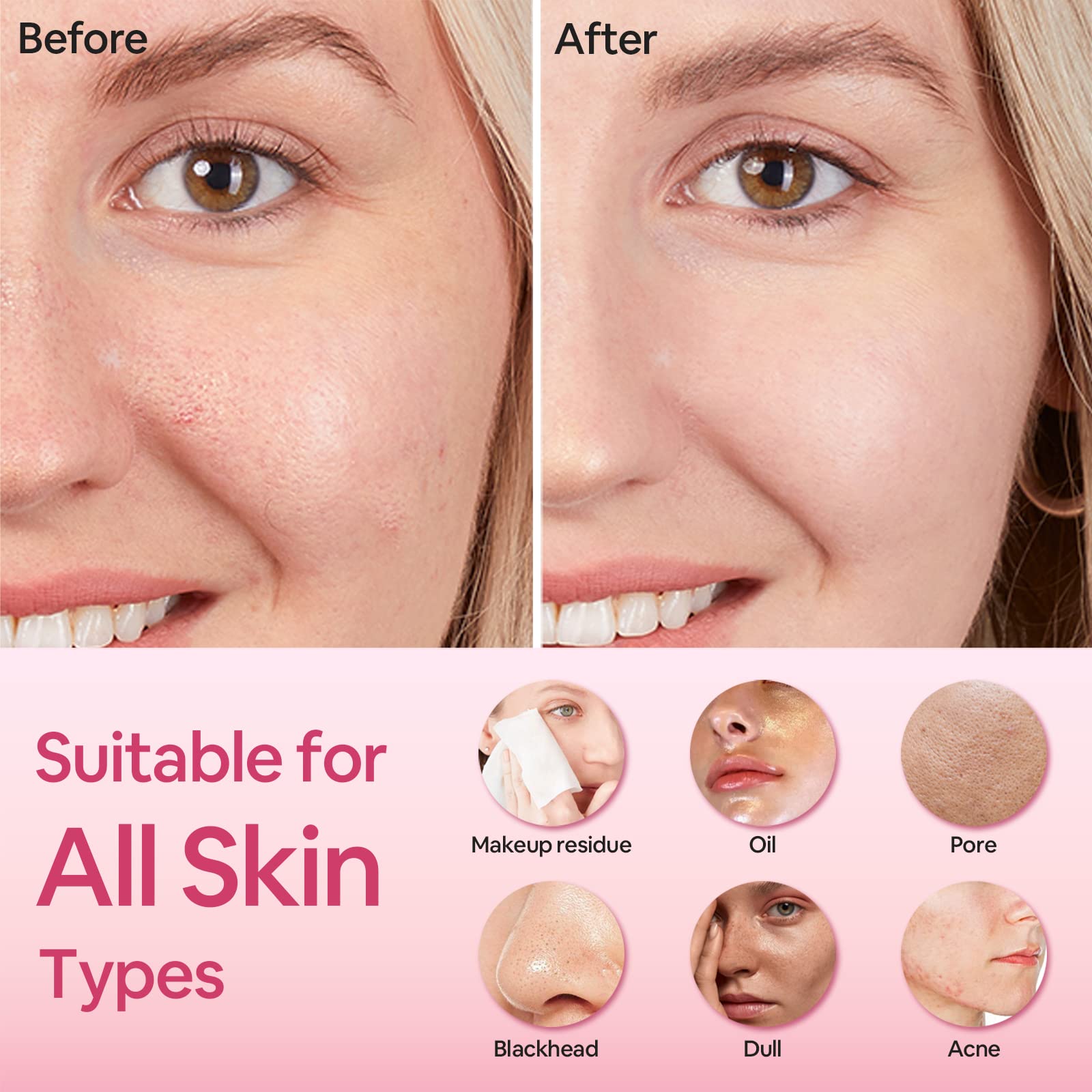 SUNMAY Oval Sonico Spazzola Viso Pulizia e Dispositivo per Tonificare il Viso Massaggiatore Facciale con Funzione di Ioni Positivi e Negativi