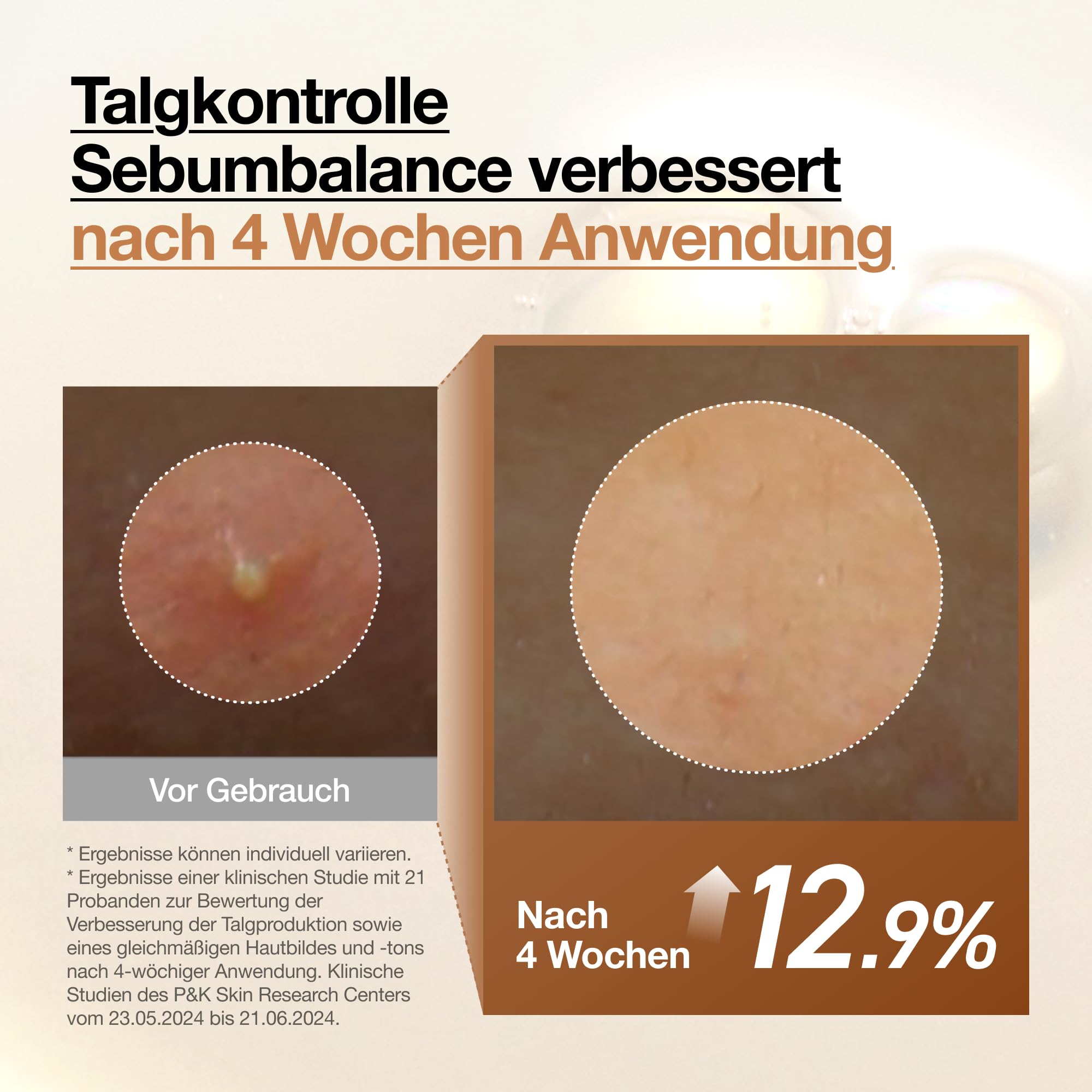 Anua Rice 70 Glow Milky Toner, Glass & Dewy Skin, Hydration & Barrier Care, Reiswasser, Niacinamid, Ceramide, Alle Hauttypen, Duftstofffrei, Nicht komedogen, Korean Skincare, 250ml