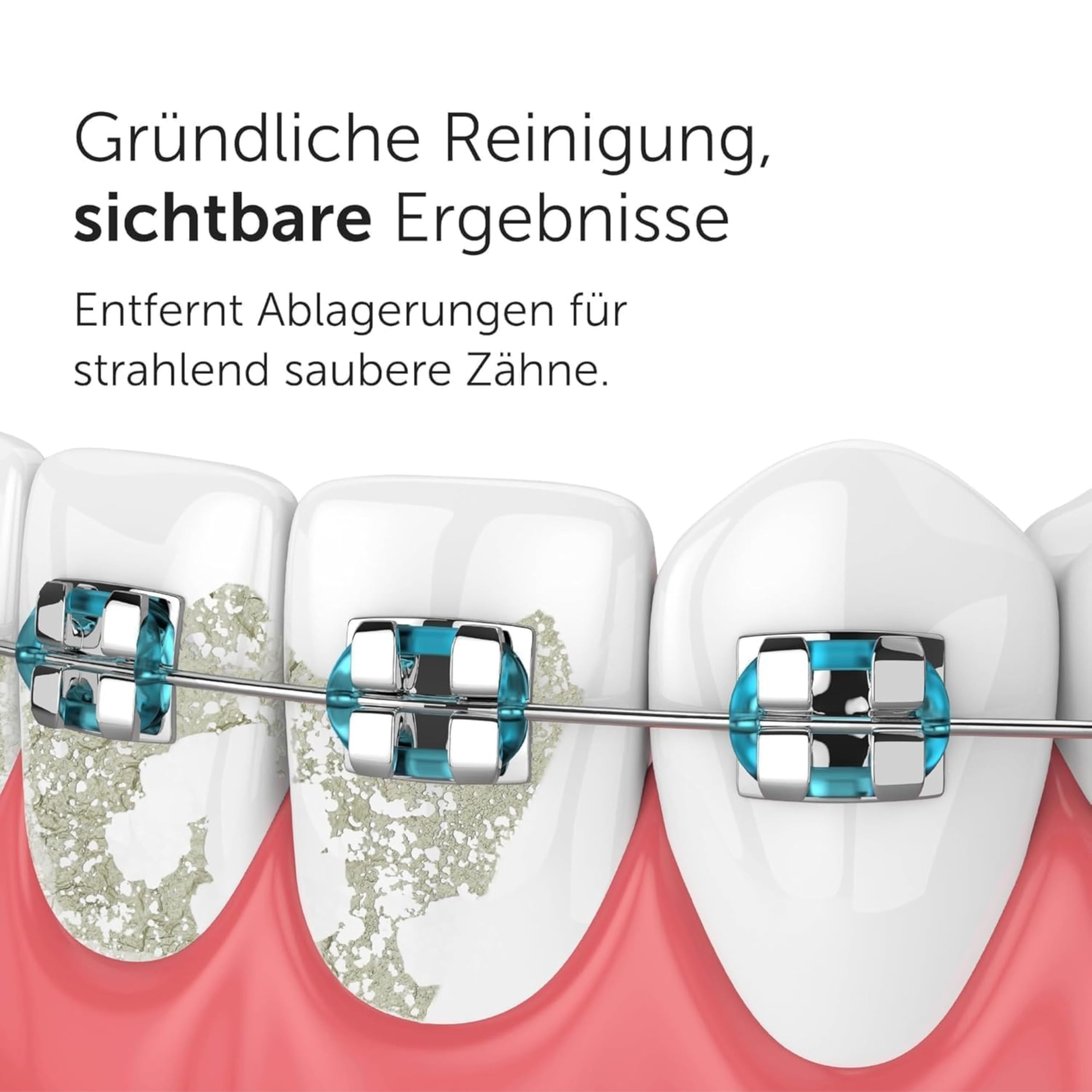 Wondersmile Munddusche PRO - Testsieger 2026-100 Tage risikofrei testen -SmoothFlow-Technologie für optimale Zahn- & Zahnfleischpflege - 5 Modi - PowerAkku 30 Tagen Laufzeit
