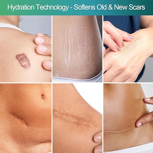 Miniatura 8 de Hojas avanzadas de silicona transparente para cicatrices, cinta de silicona de alta resistencia (1.2 x 6 pulgadas), hojas de silicona reutilizables