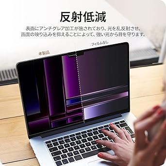 71trKgpPeGL._AC_SX342_.jpg