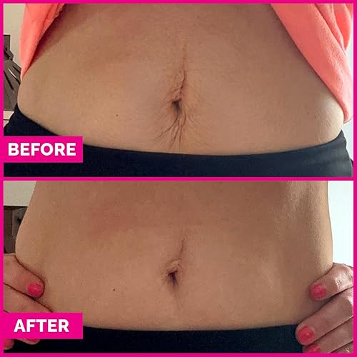 Miniatura 6 de Crema reafirmante para el estómago Tummy Sleek - Suero para tensar la piel para el vientre - Ayuda a mejorar la apariencia de la piel suelta y la