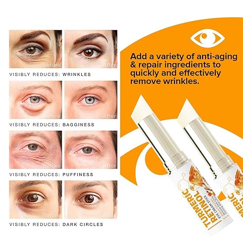 Miniatura 4 de Crema de ojos con retinol de cúrcuma, bálsamo para ojos hidratante para ojeras e hinchazón, retinol antienvejecimiento para debajo de los ojos,