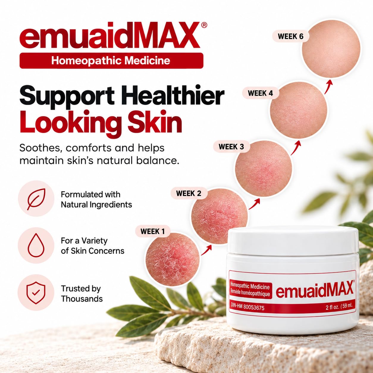 EMUAIDMAX First Aid Ointment for Eczema-Prone, Dry & Itchy Skin, 2 oz — Amazon image 3