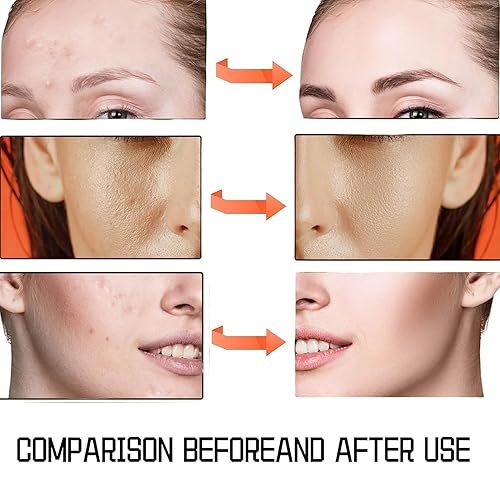 Miniatura 5 de Esencia minimizadora de poros de ácido salicílico,Suero minimizador de poros para cara,Exfoliante facial para puntos negros,Arrugas y líneas finas