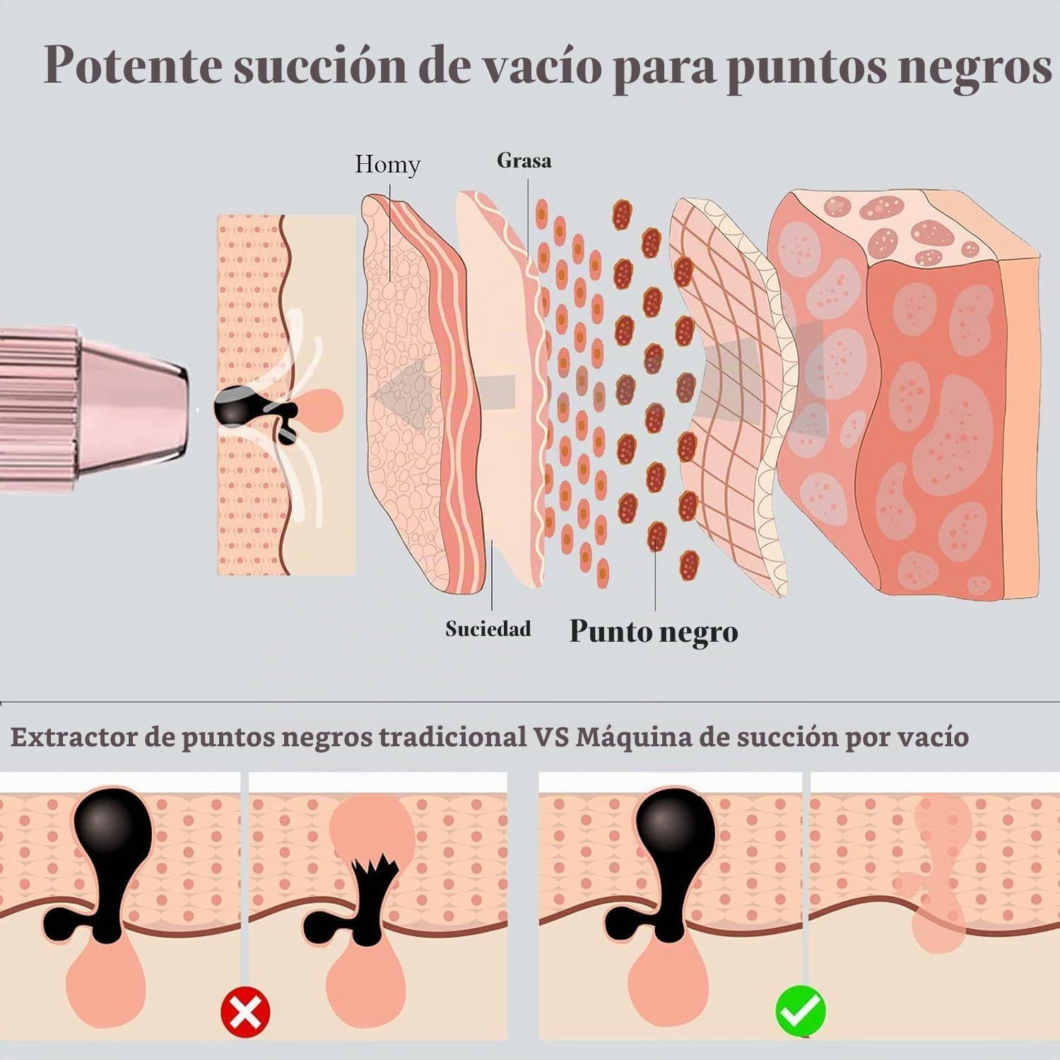 Annmiir Limpiador de Poros Succionador de Puntos Negros 5 modos de succión Limpiador Facial Blackhead Remover Extractor Puntos Negros USB Recargable con Pantalla LED 5 Cabezales Pulidores Faciales