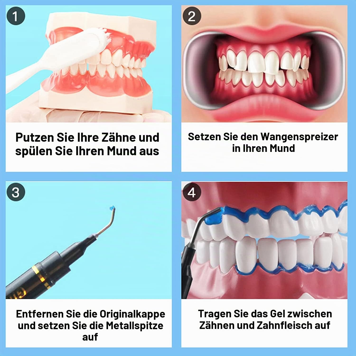 Luckin Smile 10PCS 3ML Zahnfleischschutz-Gel, Zahnfleischschutz-Gel für Zahnaufhellung, geeignet für Zahnarztpraxis, Zahnarzt und Hausgebrauch