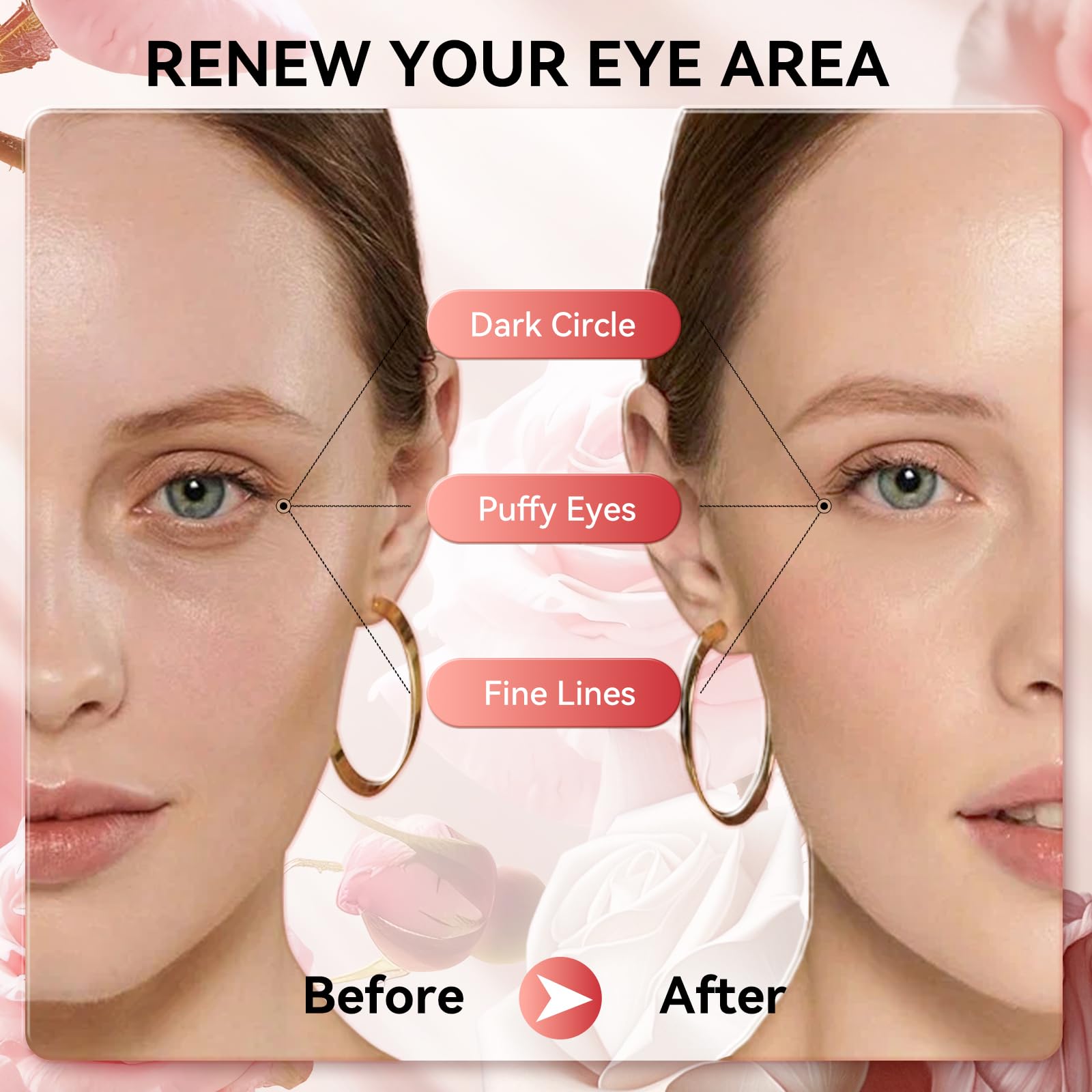 BREYLEE Aloe Vera Eye Masks– 60 Pcs - Puffy Eyes and Dark Circles Treatments – Look Younger and Reduce Wrinkles and Fine Lines Undereye, Improve and Firm eye Skin - Pure Natural Material Extraction: pink