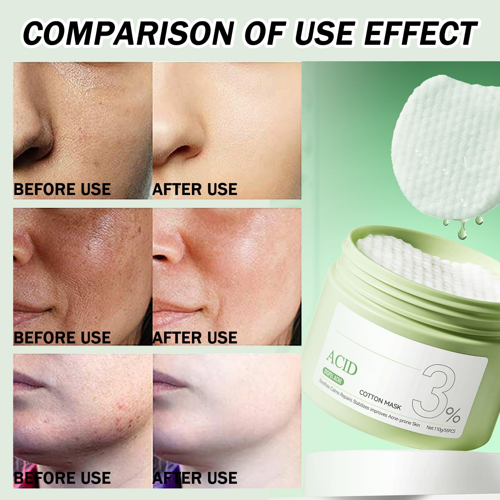 Zits-Fighting Exfoliating Face Pads, Toner & Cleansing Wipes for Oily & Zits-Prone Skin, Improve Blackheads, Enhance Skincare - Image 4