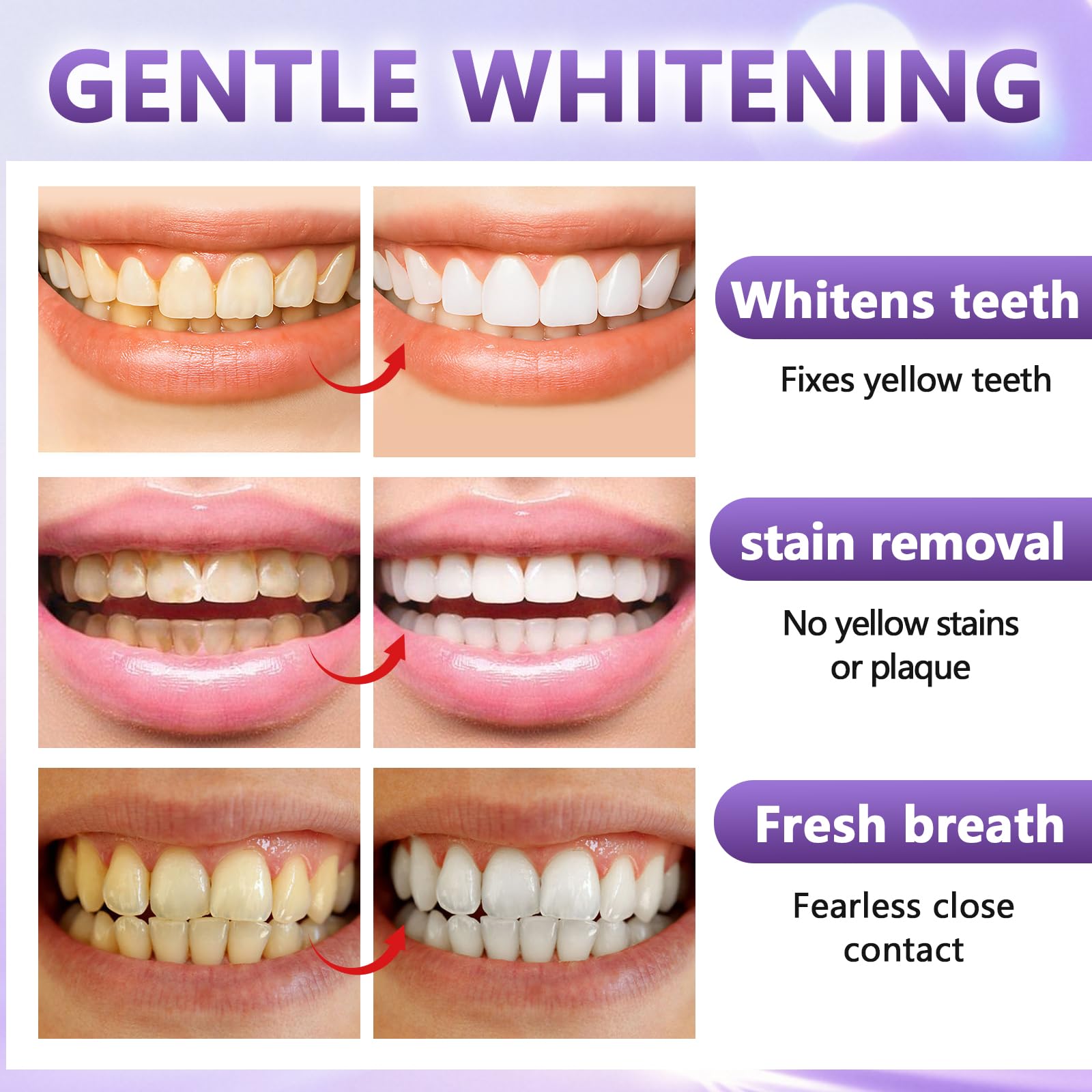14 Paia Strisce Sbiancanti Denti Viola, Kit Sbiancamento Denti A Casa Senza, Antiscivolo Whitening Strips, Sbiancante Rapide Bianche Teeth, Facile Uso A Casa O In Viaggio