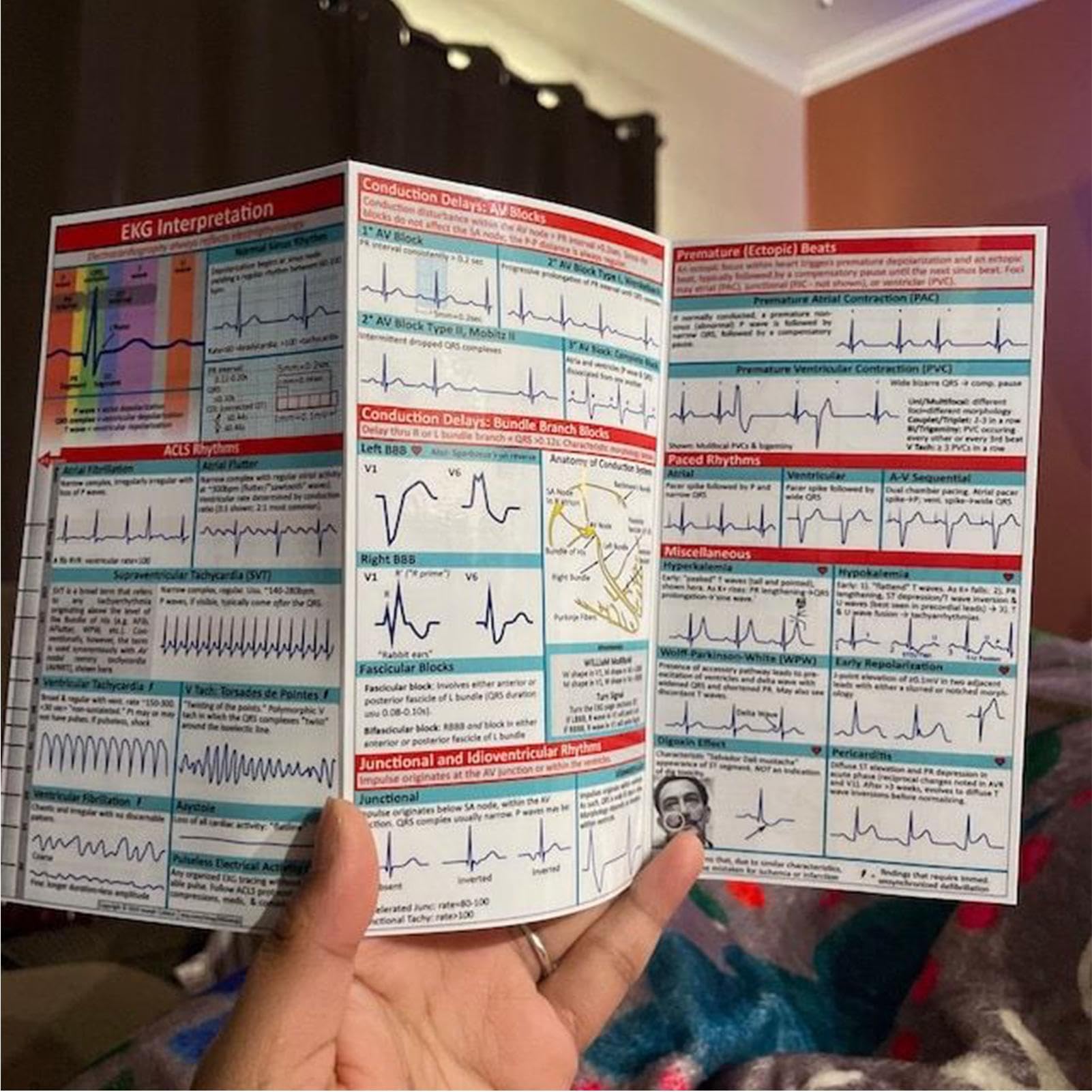 EKG Pocket Guide, Ecg Pocket Card, EKG Rhythmus Interpretation, Double Sided Compact & Portable Reference Card, Sanitäter Flash Cards, Rapid Interpretation EKG Pocket Nurses Guide