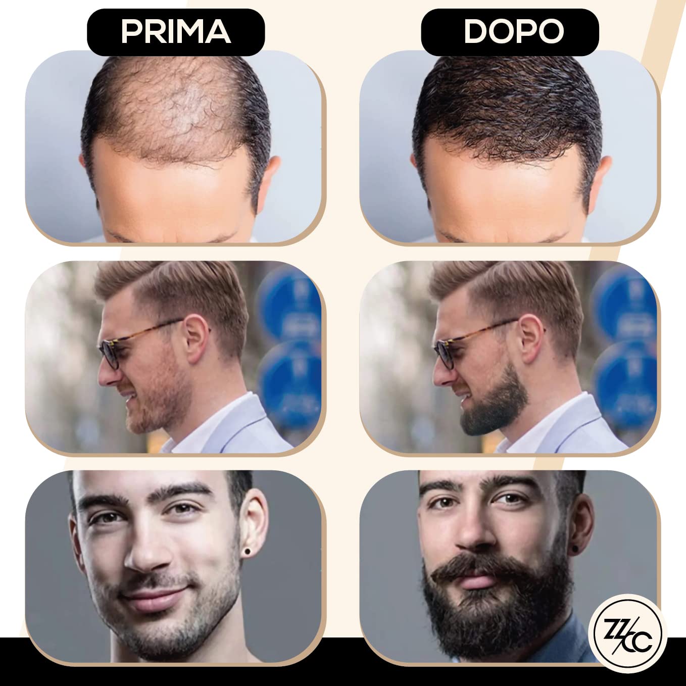 Dermaroller Crescita Barba E Capelli Da 0.5 Mm - Rullo Con Aghi In Titanio E Guida Ebook Dettagliata In Italiano - Trattamento Efficace Anche Per Cicatrici Smagliature Acne
