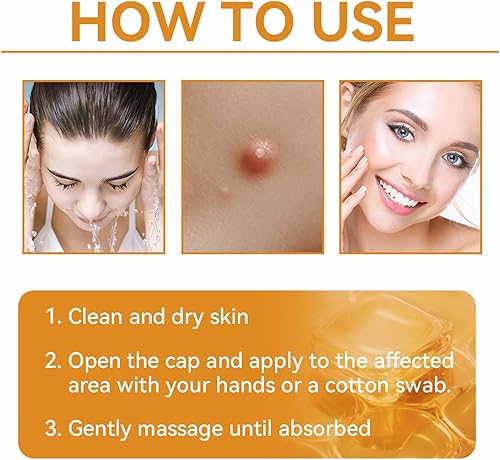 Miniatura 7 de AAFQ Bee Venom Treament & Removal Crema, hidratantes faciales y reparación de la piel para hombres y mujeres, 1.0 fl oz (1)