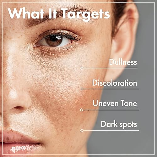 Miniatura 2 de TOSOWOONG Arbutin 7% Crema de glutatión, 70,000 ppm de arbutina + 5,001 ppm de glutatión, niacinamida, manchas oscuras, pecas, manchas,