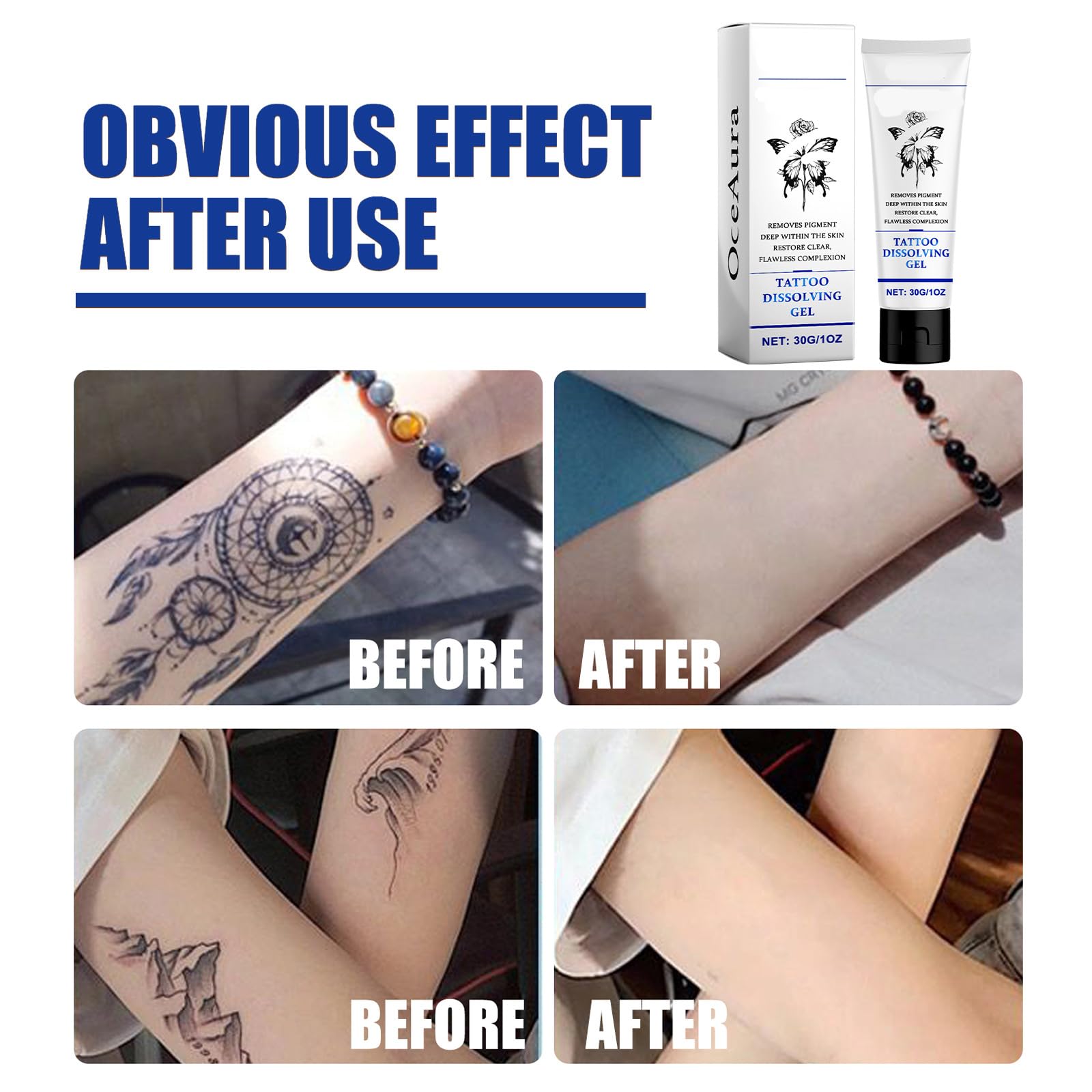 (02, F) Crema para Eliminar Tatuajes Naturalmente, Extracto de Planta, Rápida y Sin Dolor
