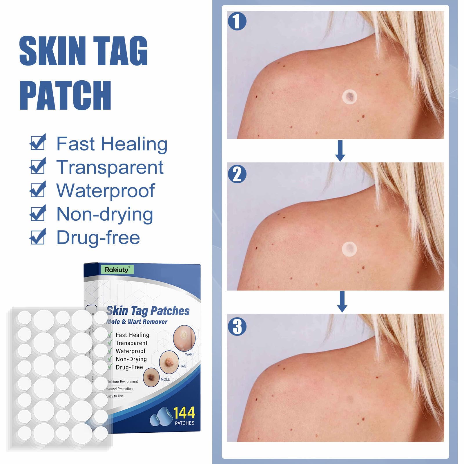 Wart and Mole Removal Patches,Parches Quita Verrugas Cuello y Cara,Producto de Verrugas,Skin Tag Removal Patches,Parches Quita Wart Cuello y Cara,para Mujer Hombre,144 Piezas