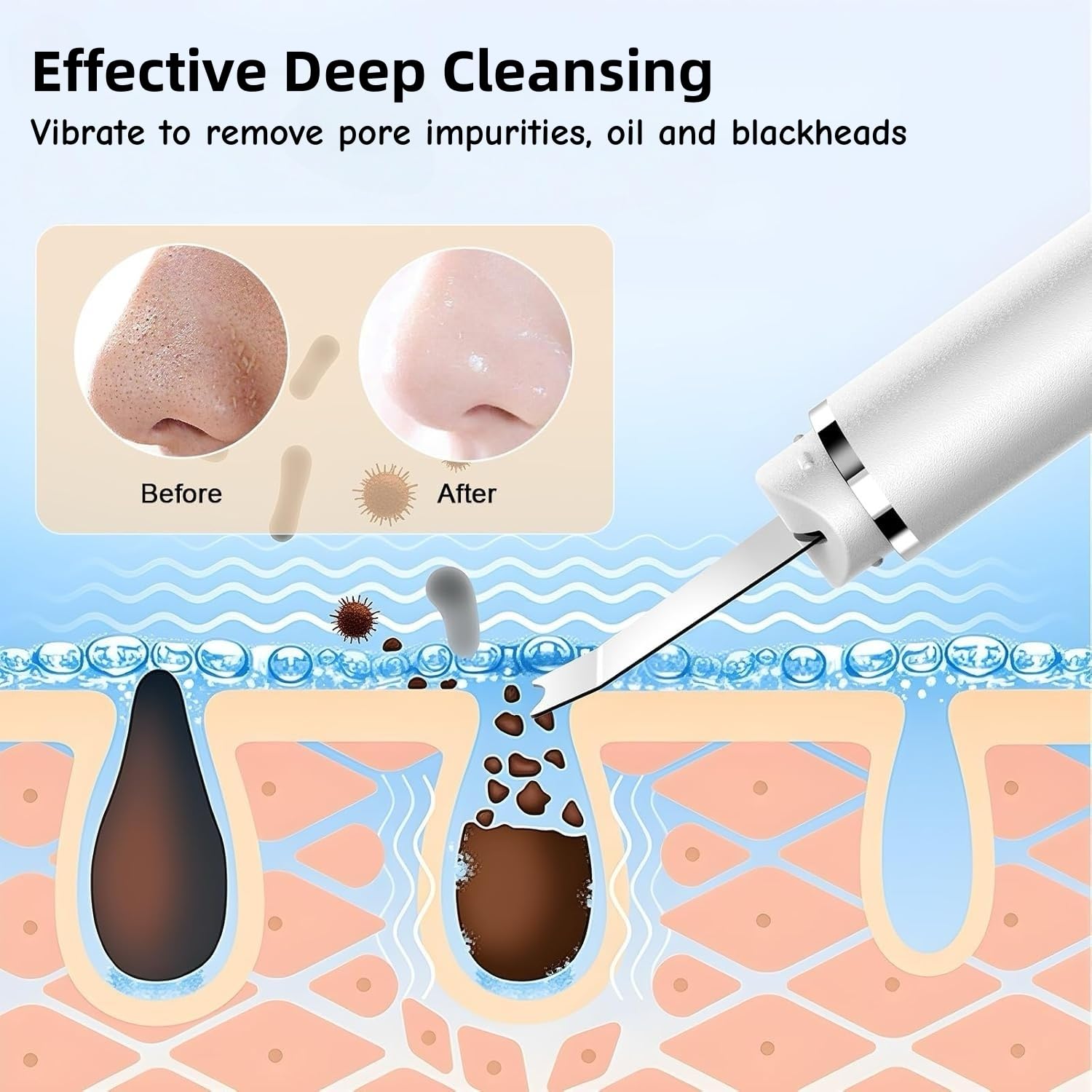 Appareil exfoliant ultrasonique pour la peau, élimine les points noirs, nettoie les pores et les rides, nettoie le visage en profondeur, 4 modes, rechargeable par USB, 2 protections en silicone
