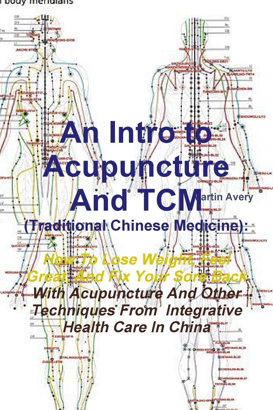 Buy An Intro to Acupuncture and Tcm (Traditional Chinese Medicine) How