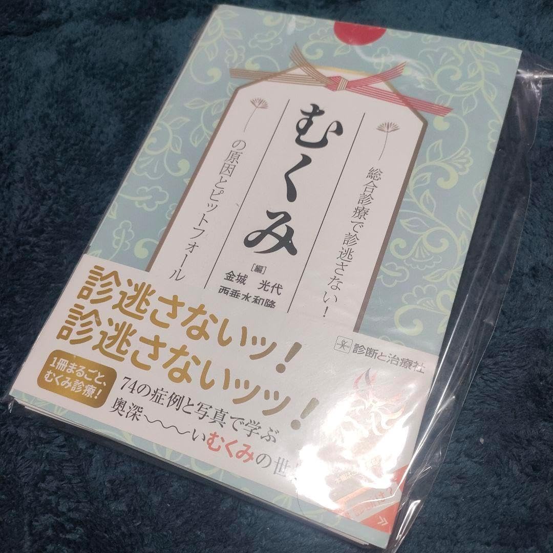 むくみの原因とピットフォール裁断済み