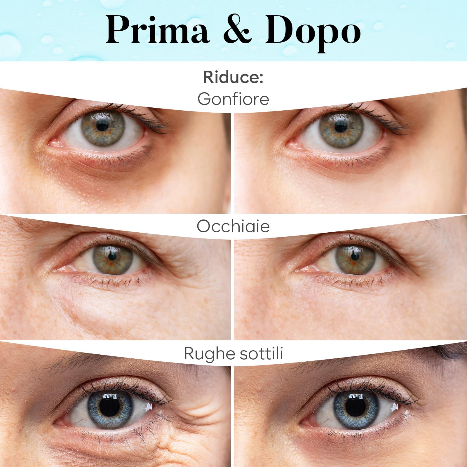 AURAE Patch Occhi, Maschera Occhi con Retinolo e Collagene, Patch Occhiaie e Borse, Maschera Occhiaie, Eye Mask per Schiarente e l'idratazione (30 Paia)