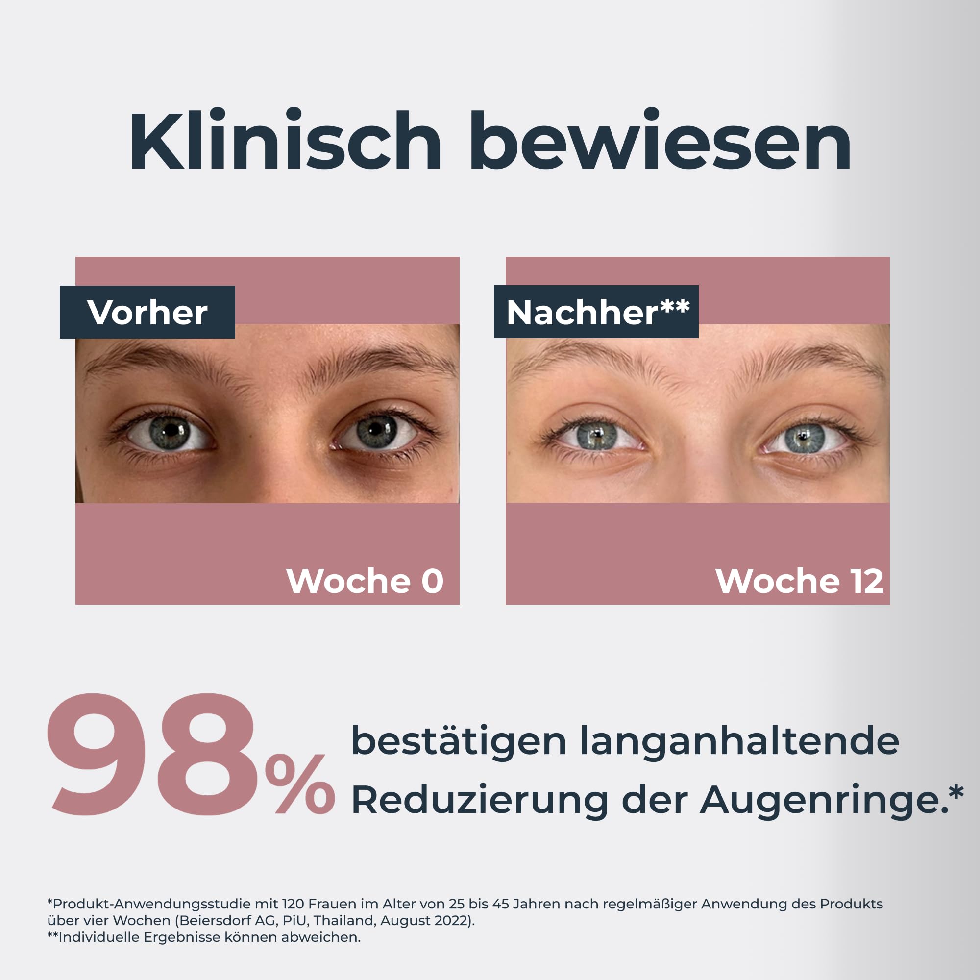 Eucerin Anti-Pigment Augenringe Korrigierende Augenpflege 15 ml, Augencreme reduziert Augenringe und Schwellungen, kühlende Formel mit Thiamidol und Hyaluronsäure für ein frisches Aussehen