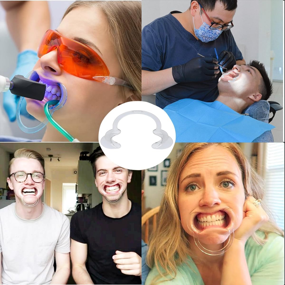 Amazon.co.jp: マウスオープナー 口開ける器具C 開口器プラスチック