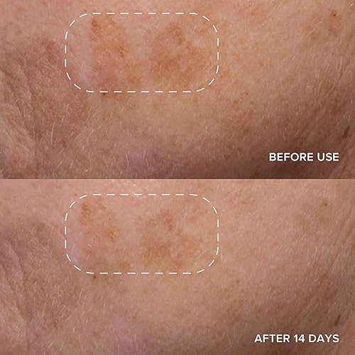 Miniatura 9 de Alpyn Complexion Perfection Bundle  Crema hidratante derretida  Vitamina C y suero de brillo de gayuba