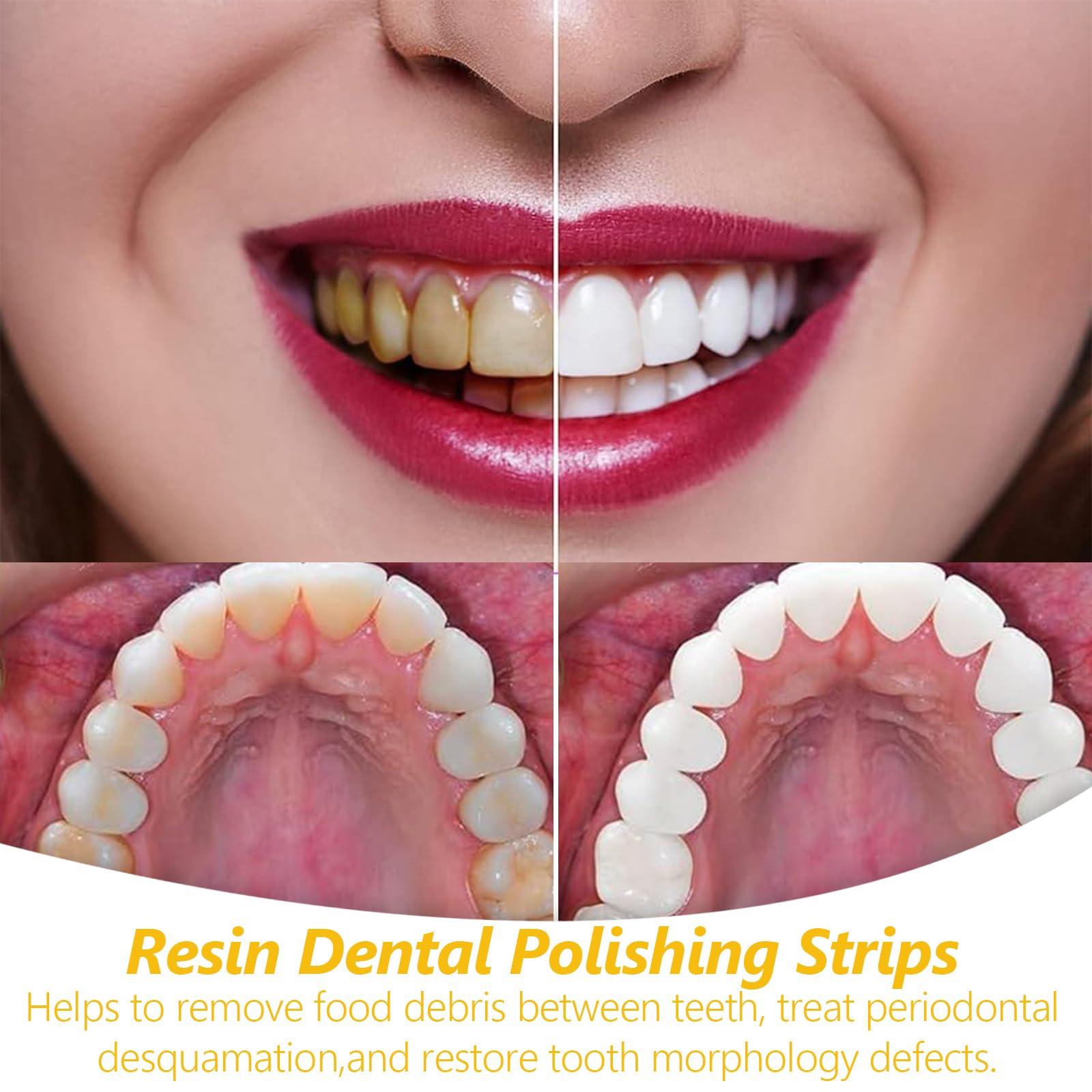 Carta Vetrata per Denti con Strisce Lucidanti, Pulizia e Lucidatura, Rimozione Tartaro, Riparazione Denti (Colorata)