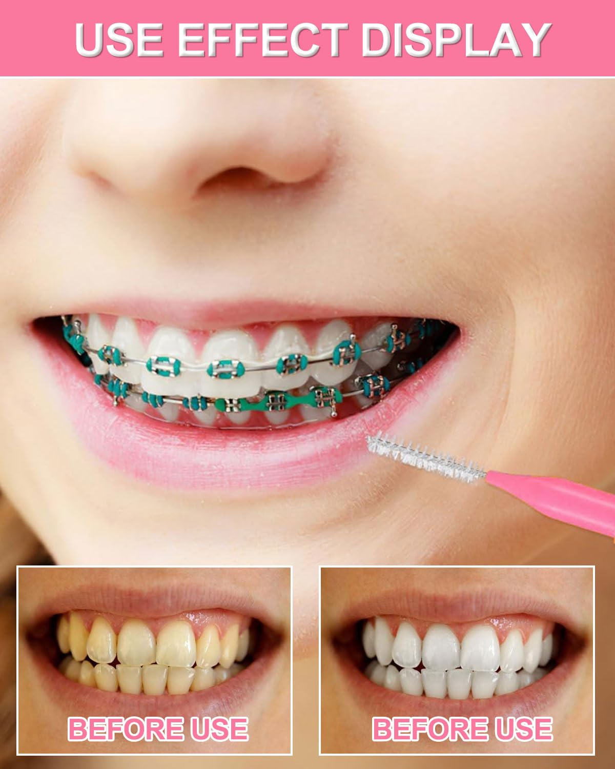 50 Pezzi Scovolini Interdentali,Scovolino per Pulizia Denti con Coperchio,Pulire Gli Spazi Stretti Tra Denti,Strumenti Pulizia Denti,Mantenere Salute Orale per Bambini,Uomini,Donne(5 Colori)