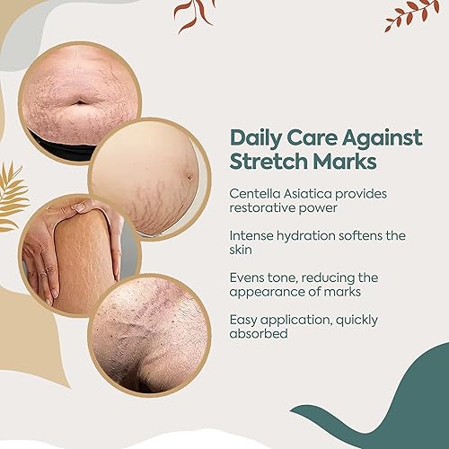 Miniatura 6 de Reduce el aspecto de cicatrices y grietas y crema preventiva perfecta (crema de cicatrices y estrías)