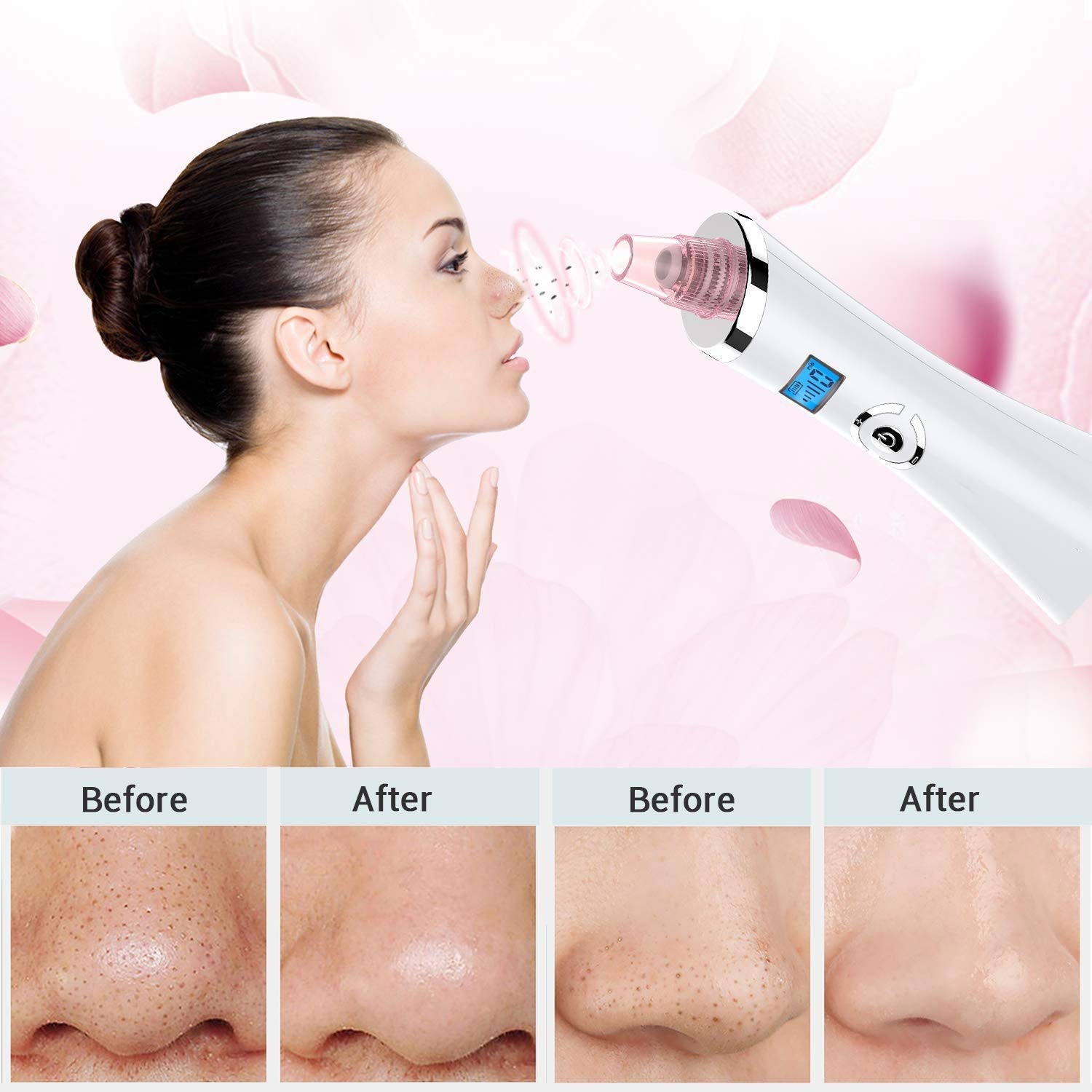 Removedor Blackhead Vacuum Professional PORUS Cleadera de vacío Acne Extractor USB Recargable LED Pantalla 5 Modos 5 Sondas reemplazables