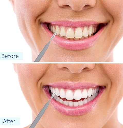 Miniatura 73 de Patelai 100 piezas de cepillos para limpiador, cepillo interdental, palillo de dientes, cabezal de hilo dental, hilo dental, higiene dental, hilo