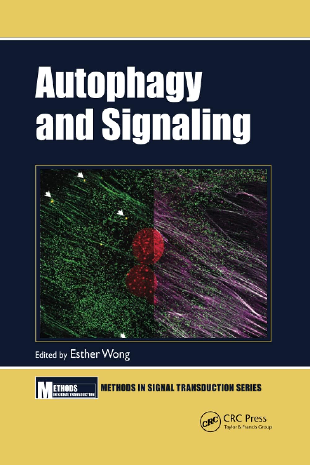 Autophagy and Signaling