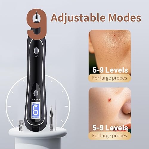 Miniatura 4 de GJW Skin Clinic Freeze Point para verrugas y anomalías de la piel - Uso amigable - Funciona para quitar anomalías de la piel