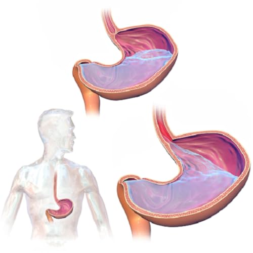 Acid Reflux Heartburn Cure App - Get rid of Acid Reflux