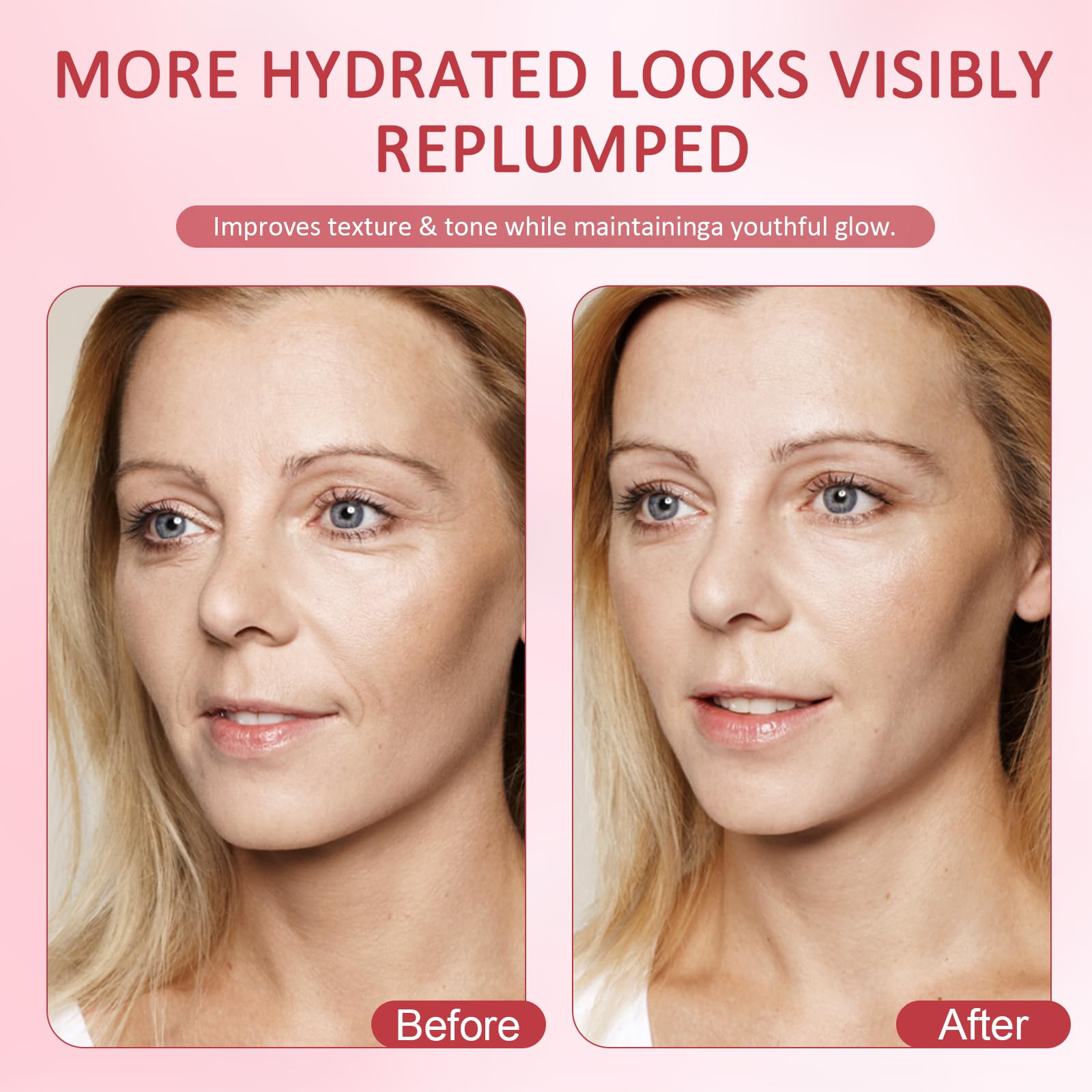 Dark Spot Correcting Serum 2PCS Niacinamide Serum,10% Niacinamide+4% Tranexamic Acid,Removes Acne Scars and Evens Skin Tone,Fragrance-Free - Image 3
