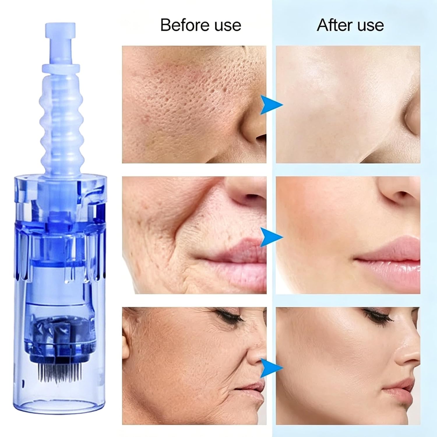 Compatible with Dr Pen A6, N2, M5, and M7 Model microneedling pen (36 needles, 10 needles per pack) 0.25mm