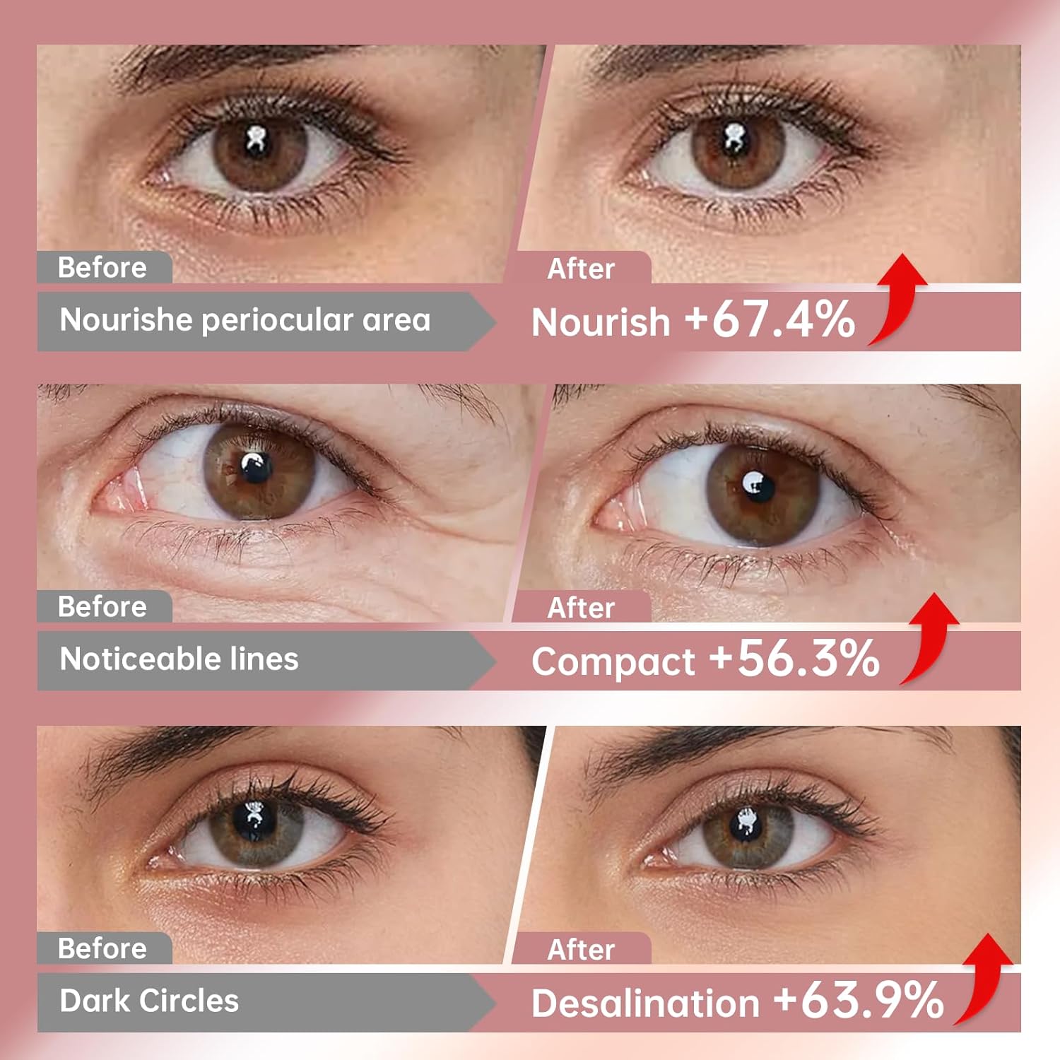 Novoy 15 Pairs Bio-Collagen Real Deep Eye Patches - 6-in-1 Retinol Overnight Eye Patches for Dark Circles, Puffiness & Wrinkles | 2% Caffeine+Hyaluronic+Niacinamide, Korean Popular Eye Mask - ROSE - Image 7