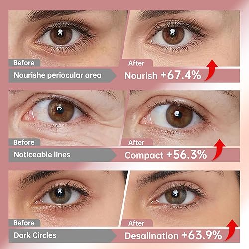 Miniatura 7 de Novoy 15 Pares de Parches de Ojos Profundos de Bio-Colágeno Real - Parches de Ojos de Retinol 6-en-1 para la Noche para Ojeras, Hinchazón y Arrugas