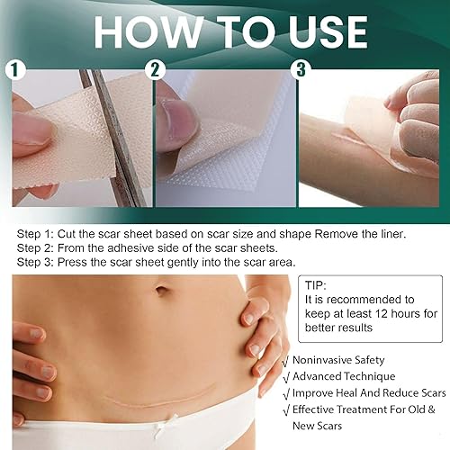 Miniatura 8 de Hojas de silicona de grado médico, (rollo de 1.6 x 120 pulgadas, 9.8 ft), cinta de silicona profesional para cicatrices, hojas de cicatrices de