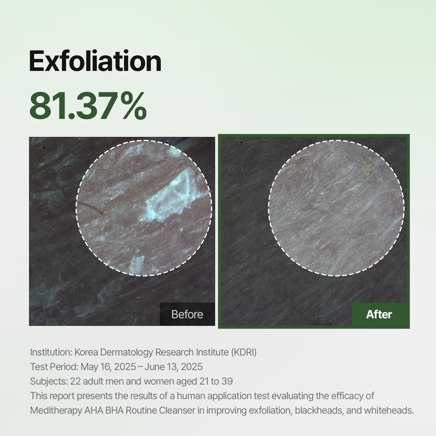 MEDITHERAPY Aha Bha Routine Cleanser 5.07 Fl. Oz – Mild Acne Face Wash for Sensitive Skin – Gel Type Deep Pore Cleanser, Blackhead Remover, Exfoliating – Korean Skin Care - Image 3