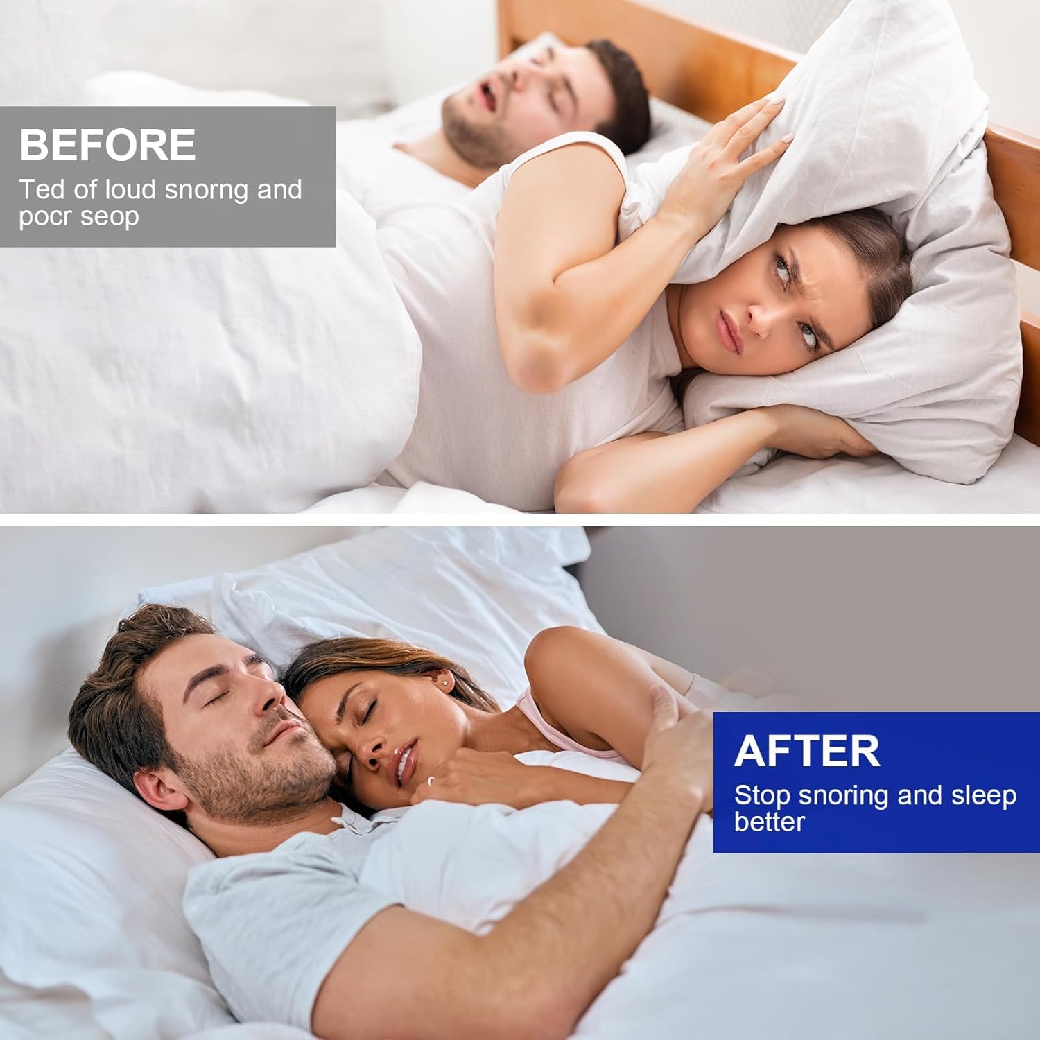 Set of 4 Anti-Snoring Splints, Anti Snoring Devices for Bruxism, Anti-Snoring Mouth Guard, for Better Sleep, Improves Sleep and Reusable