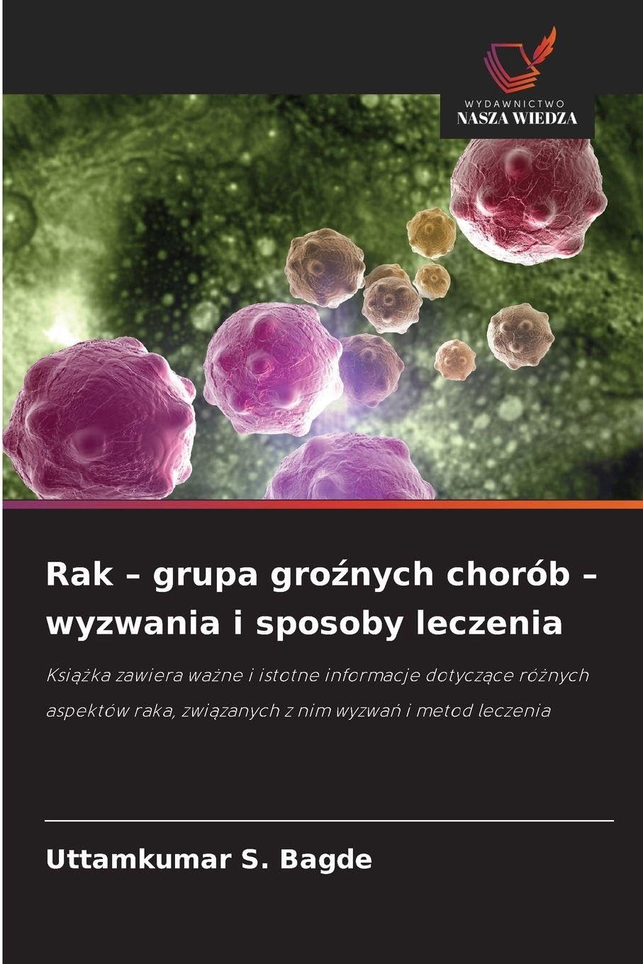 Rak - grupa groźnych chorób - wyzwania i sposoby leczenia: Ksi¿¿ka zawiera wa¿ne i istotne informacje dotycz¿ce ró¿nych aspektów raka, zwi¿zanych z nim wyzwa¿ i metod leczenia