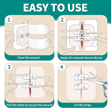 Comdian 40 Pcs Wound Closure Strips, 3 Types Butterfly Bandages Stitchless and Painless Laceration Closure Kit, Emergency Quick Clot Zip Stitch Wound Closure Device